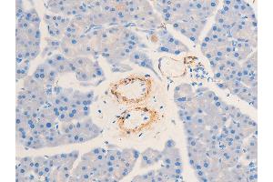 Immunohistochemistry (IHC) image for anti-Actin, alpha 2, Smooth Muscle, Aorta (ACTA2) (N-Term) antibody (ABIN6254917)