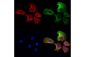 ABIN6259812 and ABIN6272986 staining Hela cells by IF/ICC. (ADRM1 抗体  (Internal Region))