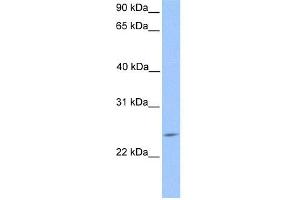 WB Suggested Anti-PTTG2 Antibody Titration:  0. (PTTG2 抗体  (Middle Region))