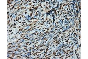 Immunohistochemical staining of paraffin-embedded liver tissue using anti-PSMC3 mouse monoclonal antibody. (PSMC3 抗体)