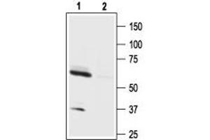 Western blot analysis of mouse brain lysate: - 1. (HCRTR1 抗体  (AA 256-269))