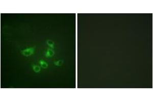 Immunofluorescence analysis of HepG2 cells, using Tryptophan Hydroxylase (Ab-58) Antibody. (Tryptophan Hydroxylase 1 抗体  (AA 26-75))