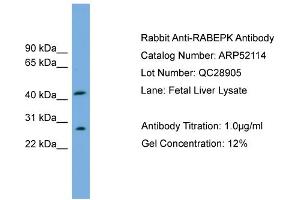 WB Suggested Anti-RABEPK  Antibody Titration: 0.