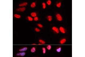 Immunofluorescence analysis of U2OS cells using PRPF3 Polyclonal Antibody (PRPF3 抗体)