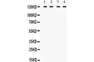 Western Blotting (WB) image for anti-Toll-Like Receptor Adaptor Molecule 1 (TICAM1) (AA 53-84), (N-Term) antibody (ABIN3043539)