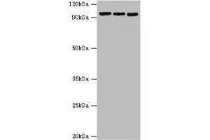Western blot All lanes: Circadian locomoter output cycles protein kaput antibody at 6 μg/mL Lane 1: Hela whole cell lysate Lane 2: NIH/3T3 whole cell lysate Lane 3: 293T whole cell lysate Secondary Goat polyclonal to rabbit IgG at 1/10000 dilution Predicted band size: 95 kDa Observed band size: 95 kDa (CLOCK 抗体  (AA 577-846))