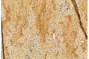 ABIN6265187 and ABIN6272863 at 1/100 staining Rat kidney tissue by IHC-P.