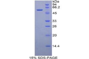 SDS-PAGE analysis of Rat CUZD1 Protein. (CUZD1 蛋白)
