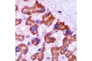 Immunohistochemistry (IHC) image for anti-Peroxisomal Biogenesis Factor 5 (PEX5) antibody (ABIN7308158) (PEX5 抗体)