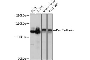 Western blot analysis of extracts of various cell lines, using Pan Cadherin antibody (ABIN7266233) at 1:3000 dilution. (CDH1,CDH2,CDH3,CDH4 (AA 800-882) 抗体)