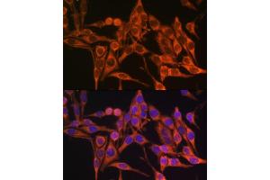 Immunofluorescence analysis of HeLa cells using MT- antibody (ABIN7268594) at dilution of 1:100. (Mitochondrially Encoded ATP Synthase 8 (MT-ATP8) 抗体)