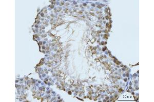 IHC analysis of GHITM using anti-GHITM antibody (ABIN7599294).