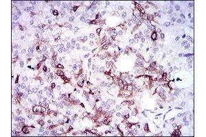 Immunohistochemistry (IHC) image for anti-Secreted phosphoprotein 1 (SPP1) (AA 167-314) antibody (ABIN1845756) (Osteopontin 抗体  (AA 167-314))