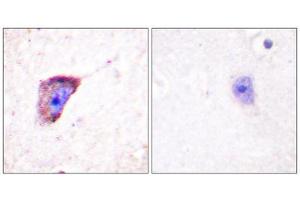 Immunohistochemistry (IHC) image for anti-Tyrosine Hydroxylase (TH) (pSer19) antibody (ABIN1847228) (Tyrosine Hydroxylase 抗体  (pSer19))