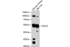 Western blot analysis of extracts of various cell lines, using F antibody (ABIN1679802, ABIN3018325, ABIN3018326 and ABIN6220437) at 1:3000 dilution. (FADS3 抗体  (AA 1-130))