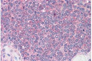 Spleen: Formalin-Fixed, Paraffin-Embedded (FFPE) (DDX3X 抗体  (Internal Region))