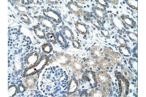 Image no. 1 for anti-Pregnancy Specific beta-1-Glycoprotein 3 (PSG3) (AA 101-150) antibody (ABIN203435) (PSG3 抗体  (AA 101-150))