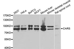 Western blot analysis of extracts of various cell lines, using CARS antibody.