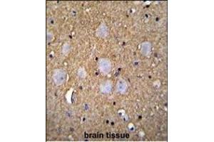 Immunohistochemistry (Paraffin-embedded Sections) (IHC (p)) image for anti-Calmodulin Regulated Spectrin Associated Protein 1 (CAMSAP1) (AA 34-62), (N-Term) antibody (ABIN655218)