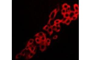 Immunofluorescent analysis of Adenosine A2a Receptor staining in LOVO cells. (Adenosine A2a Receptor 抗体  (C-Term))