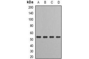 Western blot analysis of IRF-6 expression in HT29 (A), MCF7 (B), mouse kidney (C), rat liver (D) whole cell lysates. (IRF6 抗体)