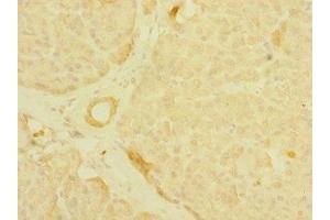 Immunohistochemistry of paraffin-embedded human pancreatic tissue using ABIN7158910 at dilution of 1:100 (MPP6 抗体  (AA 220-420))