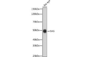 Western blot analysis of extracts of Rat eye cells, using SAG antibody (ABIN6132558, ABIN6147361, ABIN6147362 and ABIN6216887) at 1:1000 dilution. (SAG 抗体  (AA 1-405))
