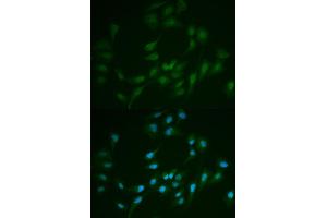 Immunofluorescence analysis of MCF7 cell using LIG1 antibody. (LIG1 抗体)