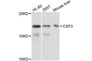 Western blot analysis of extracts of various cell lines, using CSF3 antibody (ABIN1882310) at 1:1000 dilution. (G-CSF 抗体)