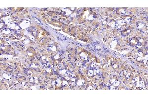 Detection of PDLIM1 in Human Stomach Tissue using Polyclonal Antibody to PDZ And LIM Domain Protein 1 (PDLIM1) (PDLIM1 抗体  (AA 2-329))