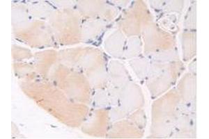 IHC-P analysis of Mouse Skeletal Muscle Tissue, with DAB staining. (Thrombospondin 1 抗体  (AA 515-671))