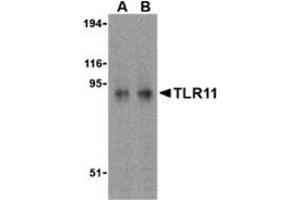 Western blot analysis of TLR11 in RAW264.