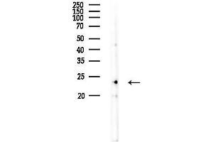 anti-BCL2-Like 2 (BCL2L2) (N-Term) antibody
