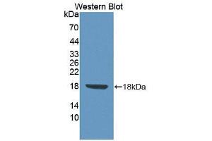 Western blot analysis of the recombinant protein. (FLRT3 抗体  (AA 29-152))