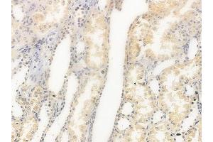 ABIN6261088 and ABIN6279261 at 1/100 staining human normal kidney tissue by IHC-P.