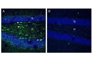 Expression of Netrin-1 in mouse hippocampus. (Netrin 1 抗体  (Secreted))