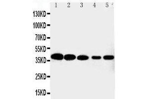 Anti-Cdk7 antibody,  Western blotting Lane 1: HELA Cell Lysate Lane 2: MCF-7 Cell Lysate Lane 3: A549 Cell Lysate Lane 4: COLO320 Cell Lysate Lane 5: JURKAT Cell Lysate (CDK7 抗体  (C-Term))