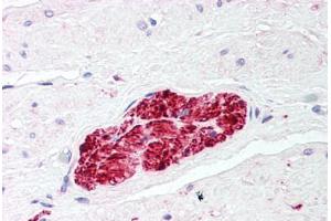Human Prostate, Nerve (formalin-fixed, paraffin-embedded) stained with S100 Protein antibody ABIN214427 at 2. (S100 Protein (S100) 抗体)
