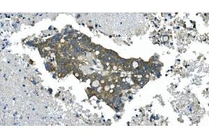 IHC analysis of CDC123 using anti-CDC123 antibody (ABIN7599284).