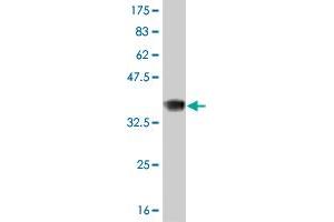 Western Blot detection against Immunogen (36. (Recoverin 抗体  (AA 101-199))