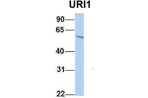Host:  Rabbit  Target Name:  URI1  Sample Type:  HepG2  Antibody Dilution:  1. (URI1 抗体  (Middle Region))