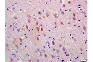 Formalin-fixed and paraffin embedded rat brain labeled with Anti-5HT3A Receptor/SR-3A Polyclonal Antibody, Unconjugated (ABIN1386182) at 1:200 followed by conjugation to the secondary antibody and DAB staining (Serotonin Receptor 3A 抗体  (AA 31-130))