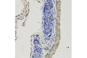 Immunohistochemistry of paraffin-embedded mouse lung using GPHN antibody (ABIN5996450) at dilution of 1/100 (40x lens). (Gephyrin 抗体)