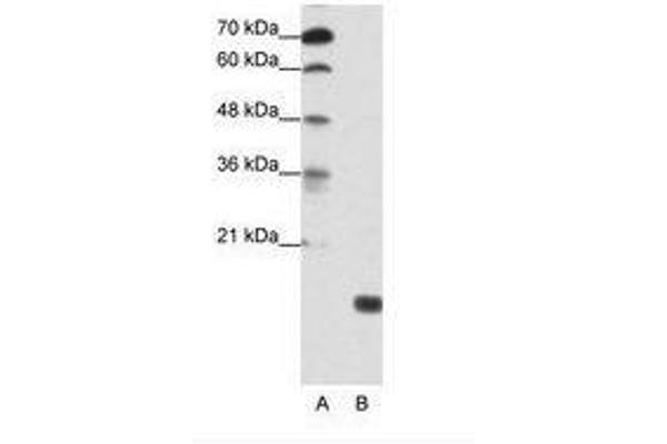 TGIF2LY anticorps  (AA 99-148)