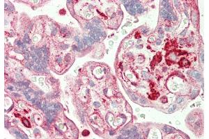 Rabbit Anti-ST3GAL4 antibody  Formalin Fixed Paraffin Embedded Tissue: Human Placenta Primary antibody Concentration: 1:200 Secondary Antibody: Donkey anti-Rabbit-Cy3 Secondary Antibody Concentration: 1:200 Magnification: 20x Exposure Time: 0. (ST3GAL4 抗体  (Middle Region))
