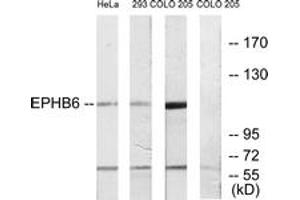 Western blot analysis of extracts from COLO/293/HeLa cells, using EPHB6 Antibody. (EPH Receptor B6 抗体  (AA 861-910))