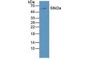 Detection of RORg in Mouse Liver Tissue using Polyclonal Antibody to RAR Related Orphan Receptor Gamma (RORg) (RORC 抗体  (AA 212-461))