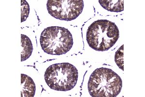 Immunohistochemistry (IHC) image for anti-WW Domain Containing Oxidoreductase (WWOX) (AA 1-245) antibody (ABIN5693294)