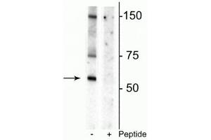 Western blot of rat striatal lysate showing specific immunolabeling of the ~55 kDa glycosylated form of the DAT protein phosphorylated at Thr53 in the first lane (-). (SLC6A3 抗体  (pThr53))