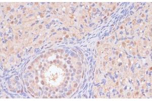 Immunohistochemistry of paraffin-embedded Rat ovary using BYSL Polyclonal Antibody at dilution of 1:100 (40x lens). (Bystin-Like 抗体)